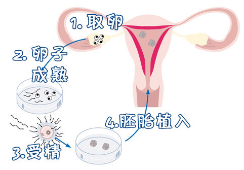 供卵代孕公司咨询